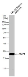Anti-UCP1 antibody used in Western Blot (WB). GTX131207